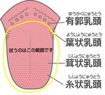 新松戸すこやか歯科　口臭　舌磨き