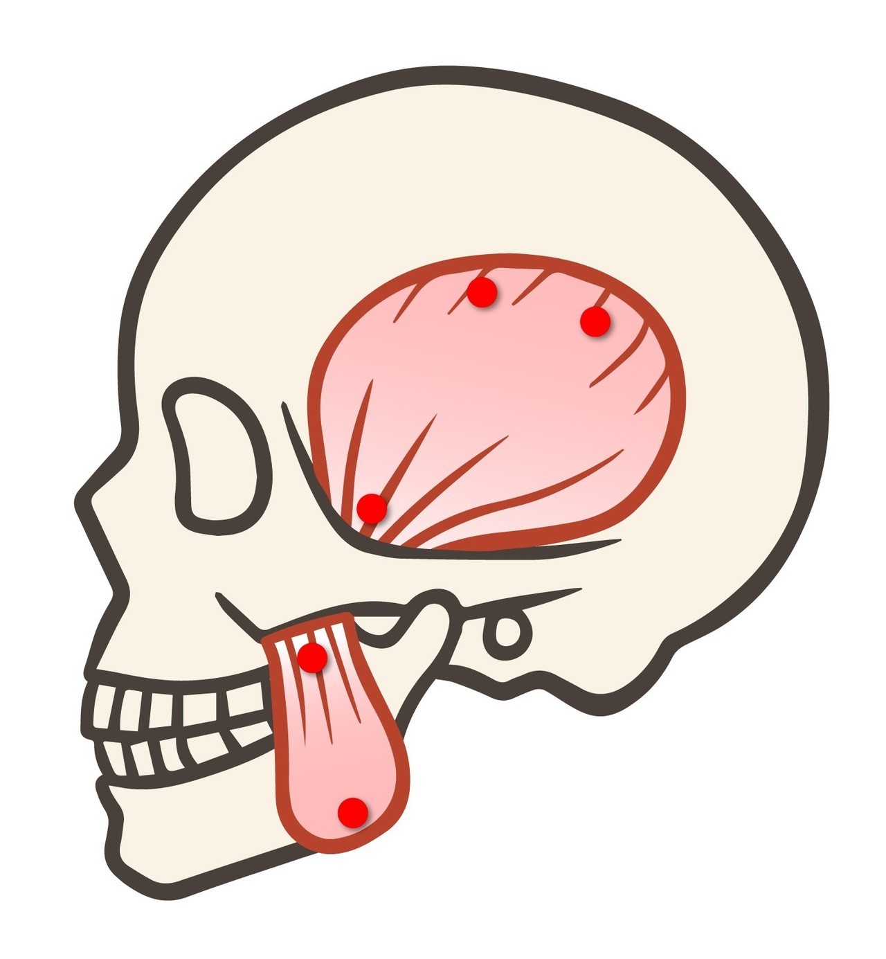 痛み　筋筋膜性疼痛　歯科
